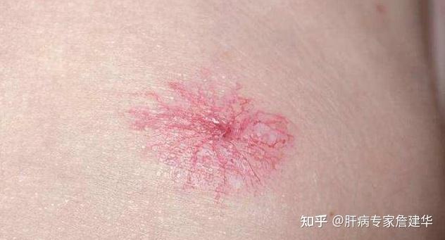 新澳800图库最新版本和代谢变差的6个表现与代谢变差的6个表现是什么